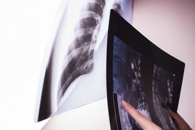 みなとみらい内科で見逃される意外な症状とは？